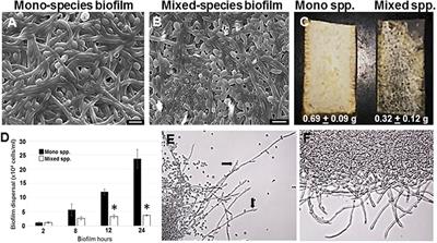 Transcriptional Profiling of C. albicans in a Two Species Biofilm with Rothia dentocariosa